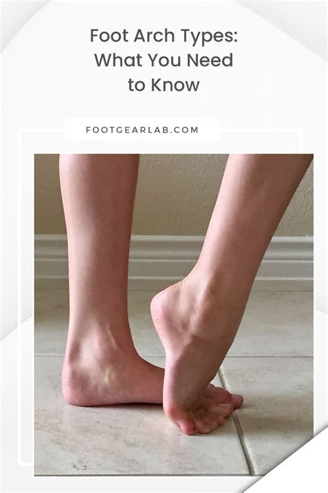 Foot arch types what you need to know – Artofit