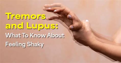 Tremors and Lupus: What To Know About Feeling Shaky | MyLupusTeam