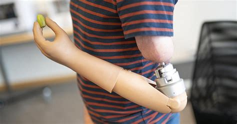 The Future of Prosthetics Might Be in This Mind-Controlled Bionic Arm