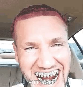 Jodyhighroller Braces GIF - JodyHighRoller Braces Silver - Discover & Share GIFs