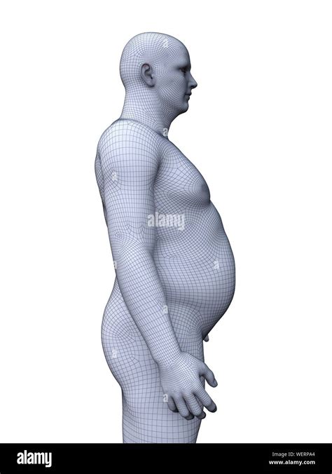 Obese man, illustration Stock Photo - Alamy