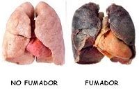 Red cubana para el control del tabaquismo – cáncer de pulmón