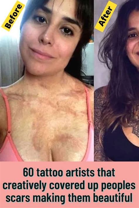 60 tattoo artists that creatively covered up peoples scars making them ...