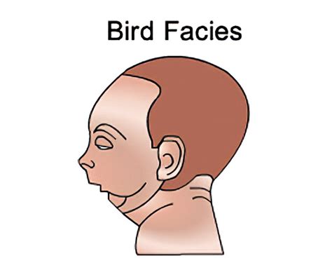 Bird Facies