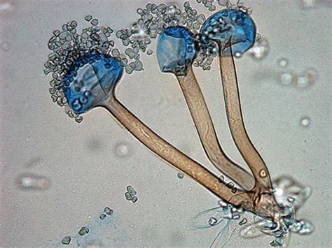 Rhizopus Oligosporus Microscope