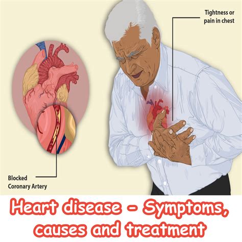 Heart disease