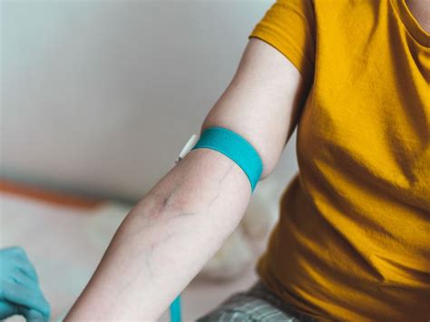 Green Veins: Why They’re That Color, Plus Conditions to Be Aware Of