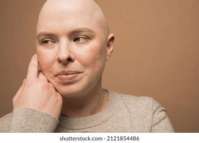 Close Portrait Thoughtful Bald Woman Alopecia Stock Photo 2121854486 ...