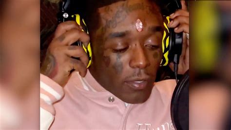 Lil Uzi Vert says fans ripped US$24 million diamond out of his forehead | CTV News