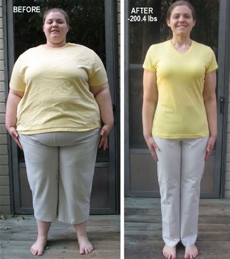 Living a Changed Life: Sheri's Inspiring Weight Loss