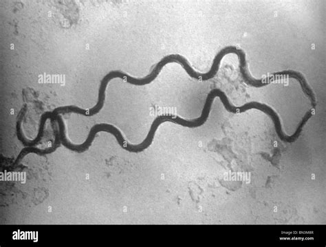 An electron photomicrograph of two spiral-shaped Treponema pallidum ...