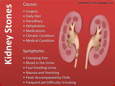 Kidney Stones Causes And Symptoms Good info. Proactive ! | Nursing mnemonics, Infographic health ...