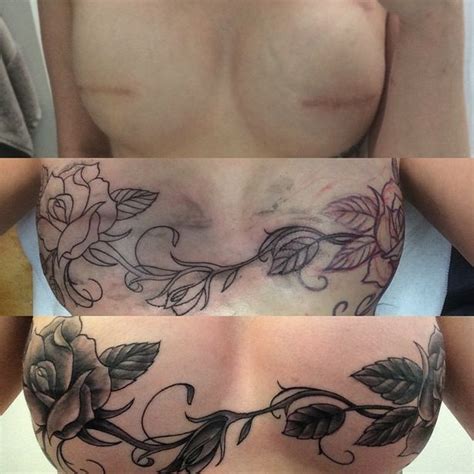 'I've taken back what cancer took' Cancer survivor has flowers tattooed ...