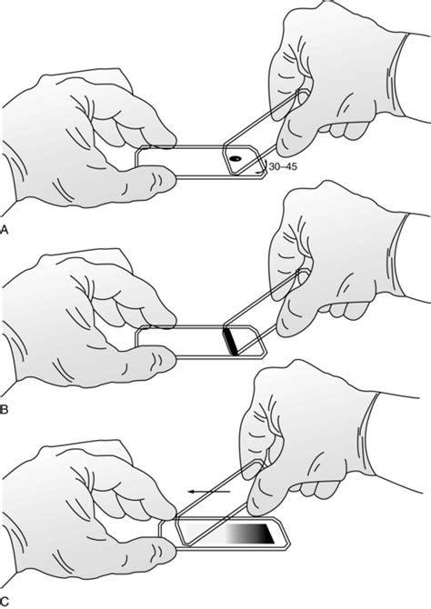 Peripheral Blood Smear Slide