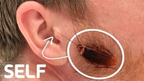 Can Cockroaches Go In Your Ear - Pest Phobia