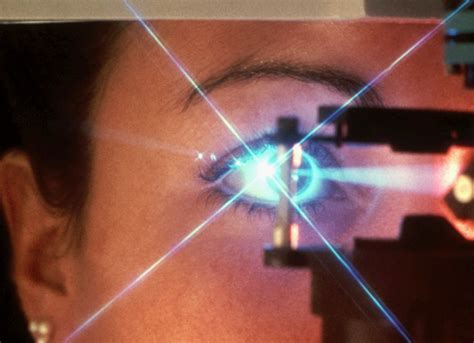 Argon Laser Treatments Can Preserve Vision in Children With Parasitic ...