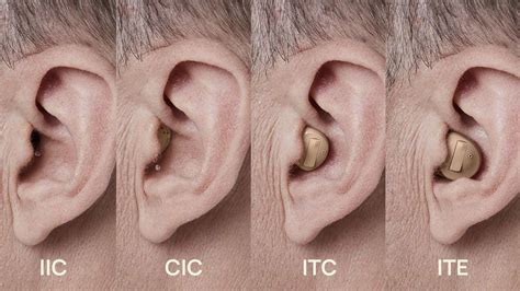 Behind-The-Ear vs. In-The-Ear Hearing Aids | How to Choose