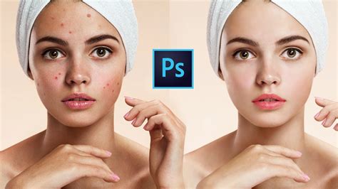 PHOTOSHOP tutorial - How to remove pimple, acne & make skin smooth - YouTube