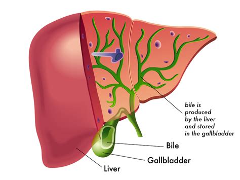 Bile and Motor Oil: Conservative Management of Small Gallbladder Stones ...