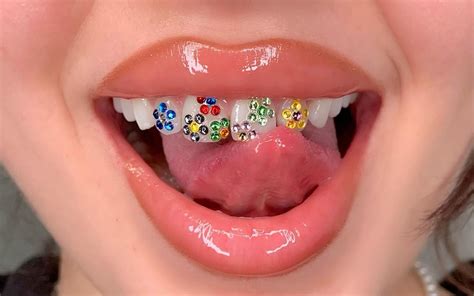 What are tooth gems and where do they come from?