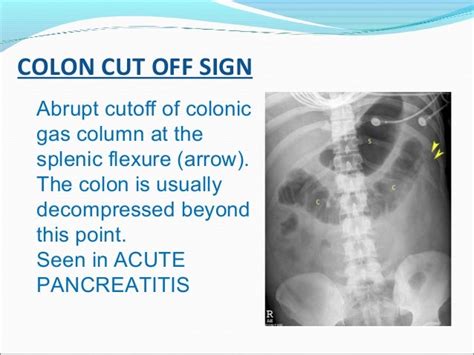 Radiology signs