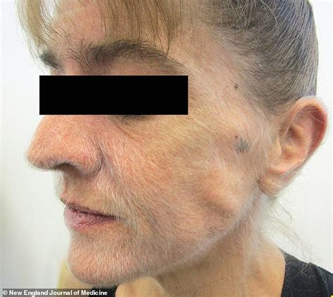 Woman who started to grow a 'beard' is shocked to learn a deadly diagnosis is to blame ...