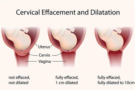 What Happens To Your Cervix During Birth Or Labor?