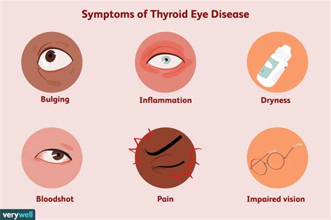 Eye socket inflammation: Orbital cellulitis: Symptoms, causes, and ...