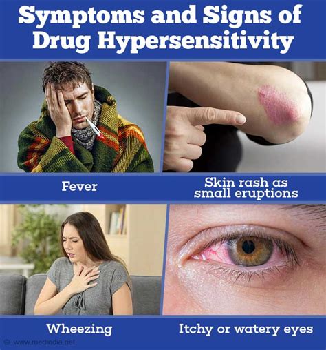 Drug Hypersensitivity - Causes, Symptoms, Types, Diagnosis, Treatment, Risk Factors and Prevention