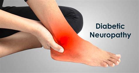 Diabetic Neuropathy- Know Its Symptoms and Causes