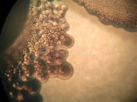 Microscope View of a Bacterial Colonies Stock Photo - Image of growing, bacteeria: 198582258