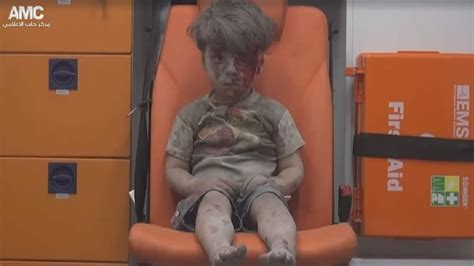 Haunting image circulates of 5-year-old Syrian boy rescued from Aleppo rubble - World - CBC News