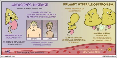 Primary Hyperaldosteronism | Addisons disease, Medical mnemonics, Nursing notes