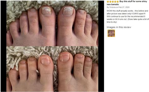 Kerasal Review - Visible Results In Just 1 Week! | Nail Care Hub