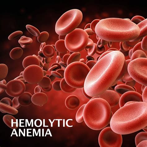 Hemolytic Anemia | Gastroenterology of Greater Orlando