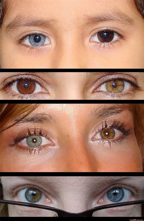 Different Eye Colors In Each Eye