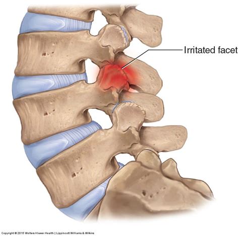 Lower Back Muscles And Ligaments - Anatomy Of The Back Spine And Back ...