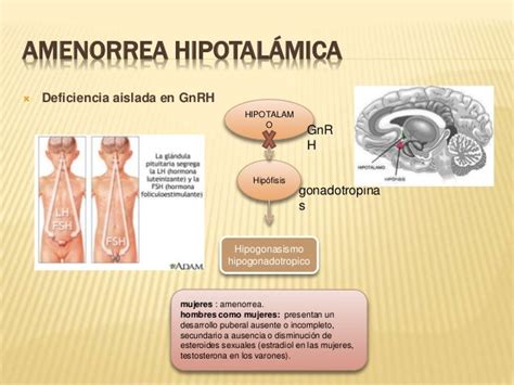 Amenorrea por causas hipofisiaria