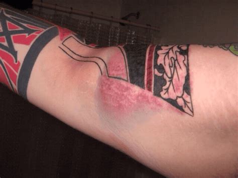 Infected Tattoo Stages: Signs of Infection from Tattoos and After ...