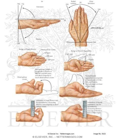 Measurement of Wrist Motion and Finger Motion, Lack of Finger Flexion, and Thumb Opposition