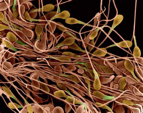 Human Sperm Photograph by Dennis Kunkel Microscopy/science Photo Library