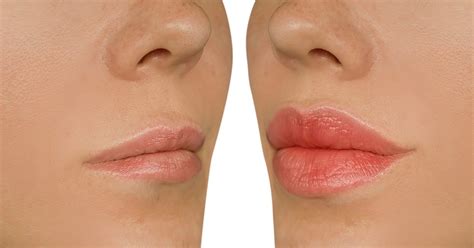 This 2-in-1 Treatment Plumps Up Lips — SALE! - This 2-in-1 Treatment ...