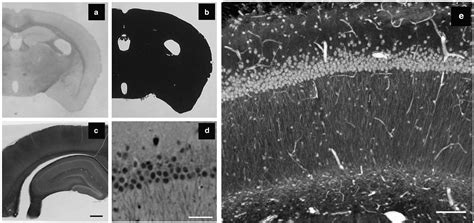 X-ray Microscopy for SBEM