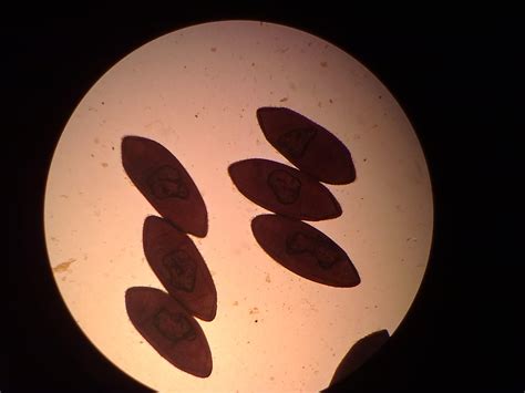 Karya Lilind Kecil: Praktikum Parasitologi