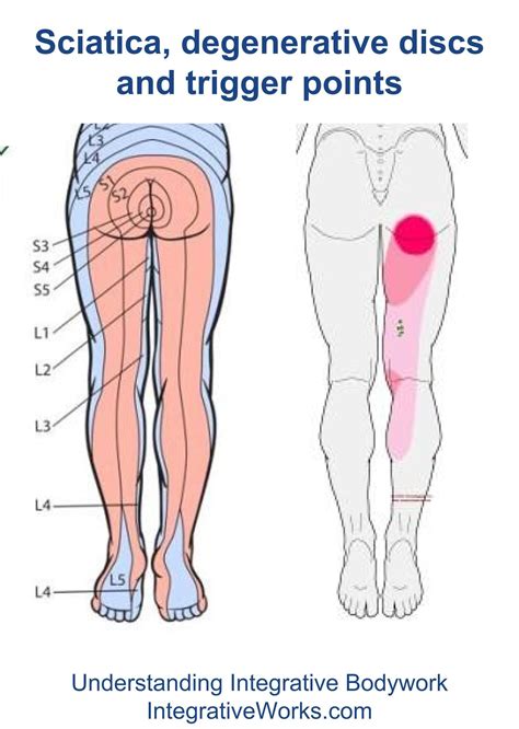 Pin on Trigger points