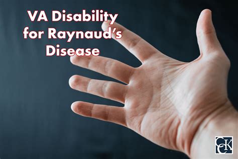 VA Disability Benefits for Raynaud's Disease | CCK Law