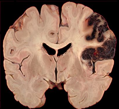 Study links honesty to prefrontal region of the brain | Research UC Berkeley