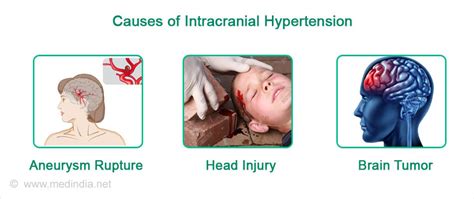 Intracranial Hypertension - Causes, Risk factors, Symptoms, Diagnosis ...