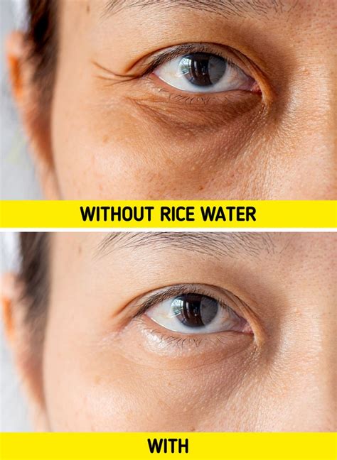 6 Reasons Why Rice Water Ought to Be Your Daily Companion / Bright Side