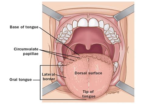 Tongue - Focus Dentistry